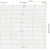 Metcheck M/W/1915/X Barograph Chart - Metcheck